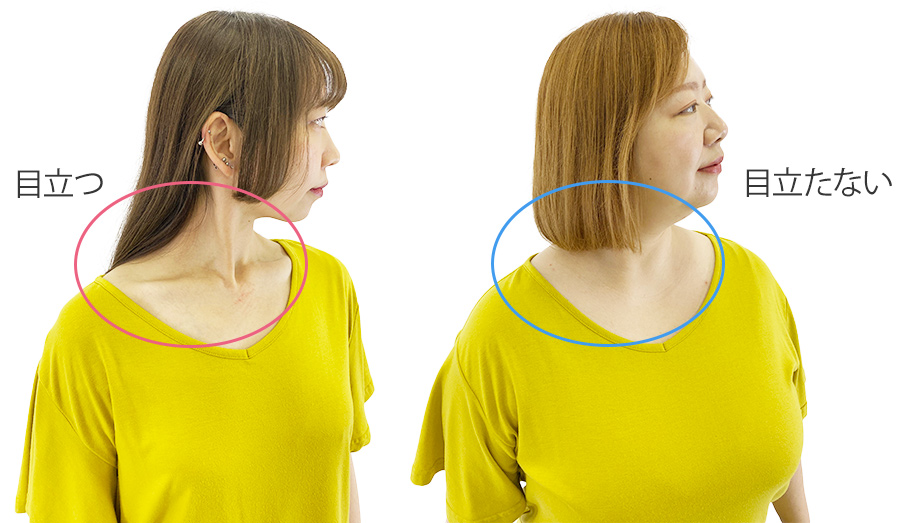 鎖骨や首の筋が目立つor目立たない ぽっちゃり女子のための骨格診断
